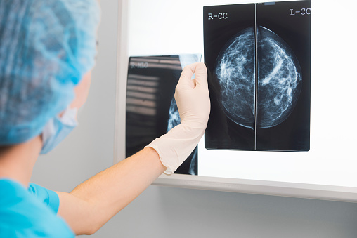 Why Do I Need a Mammogram?