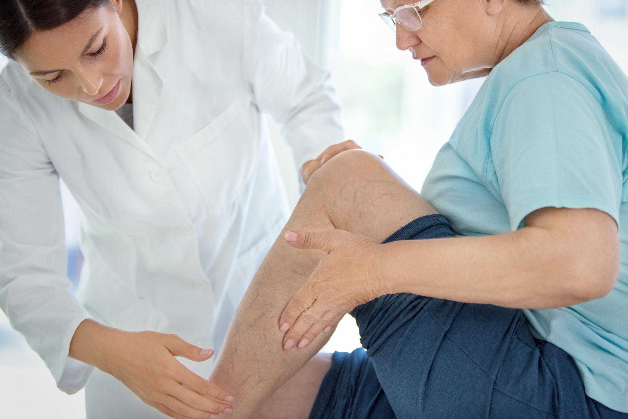 Treatment Options for Varicose Veins